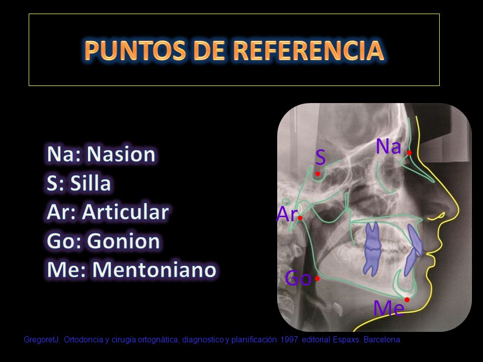 PUNTOS DE REFERENCIA Na: Nasion Na S: Silla S Ar: Articular Go: Gonion