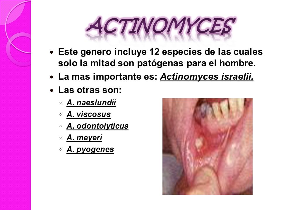 Actinomyces Este genero incluye 12 especies de las cuales solo la mitad son patógenas para el hombre.