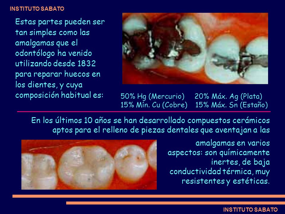 Estas partes pueden ser tan simples como las amalgamas que el odontólogo ha venido utilizando desde 1832 para reparar huecos en los dientes, y cuya composición habitual es: