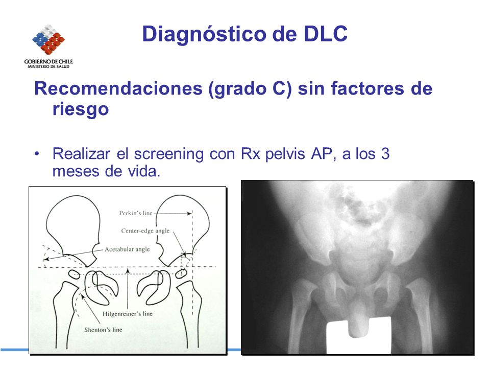 Diagnóstico de DLC Recomendaciones (grado C) sin factores de riesgo