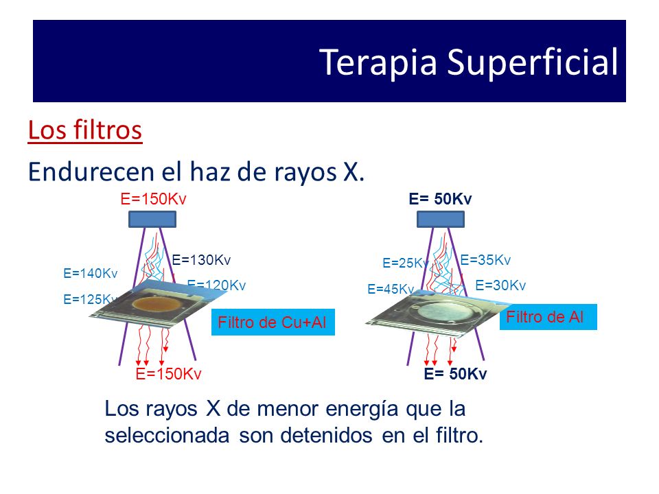 Terapia Superficial Los filtros Endurecen el haz de rayos X.
