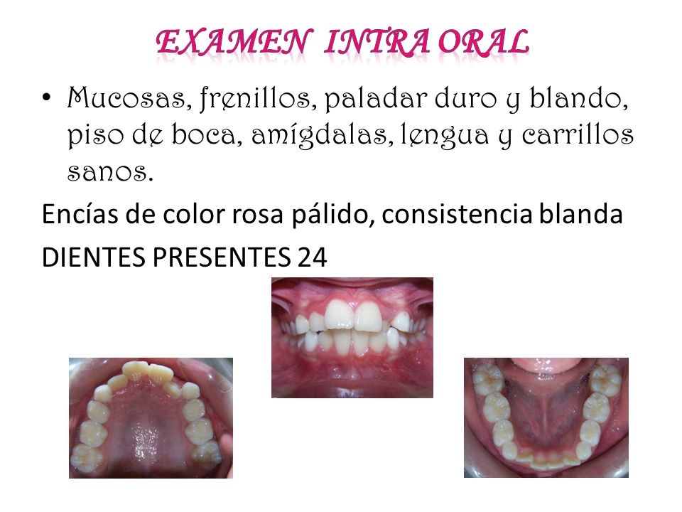 Examen intra oral Mucosas, frenillos, paladar duro y blando, piso de boca, amígdalas, lengua y carrillos sanos.