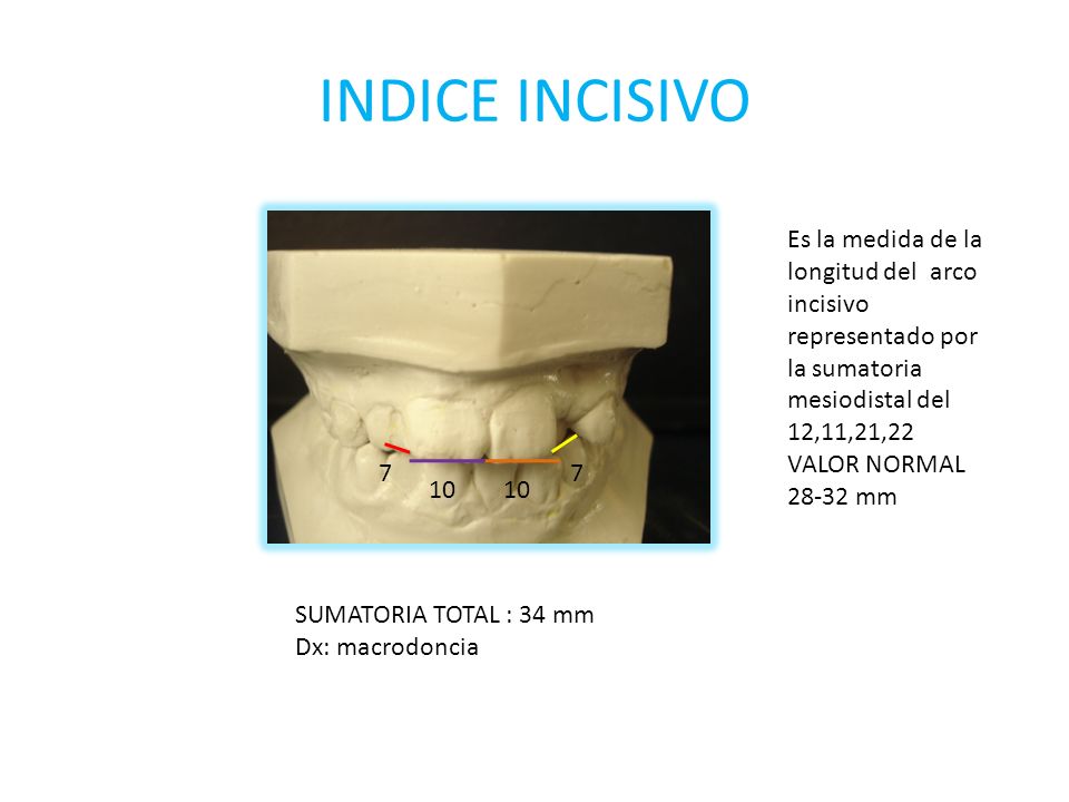 INDICE INCISIVO Es la medida de la longitud del arco incisivo representado por la sumatoria mesiodistal del 12,11,21,22.