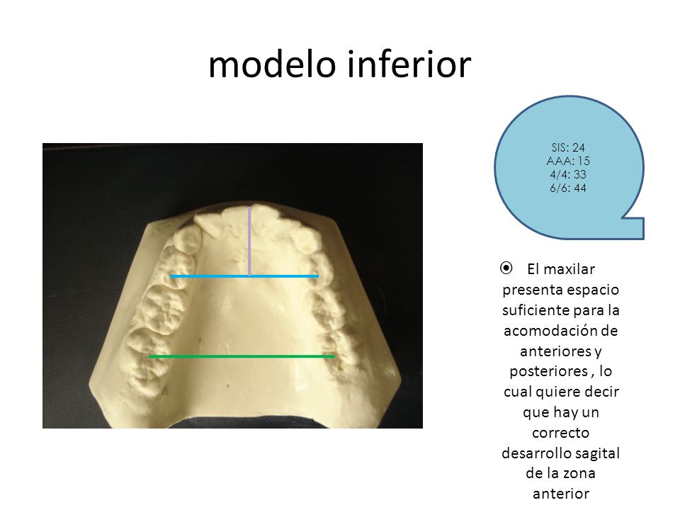 modelo inferior SIS: 24. AAA: 15. 4/4: 33. 6/6: 44.