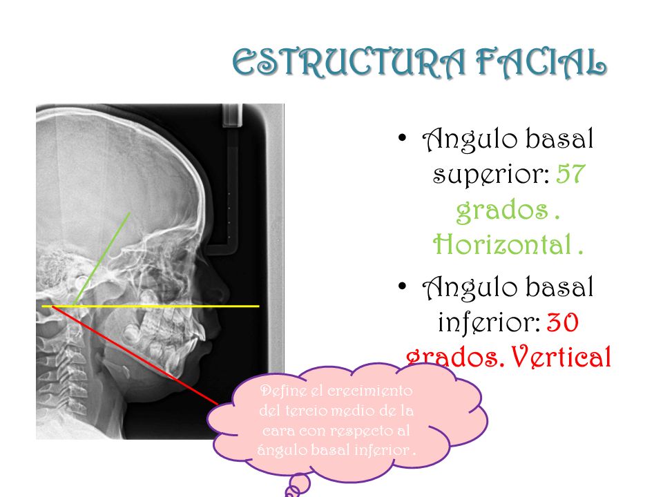 ESTRUCTURA FACIAL Angulo basal superior: 57 grados . Horizontal .