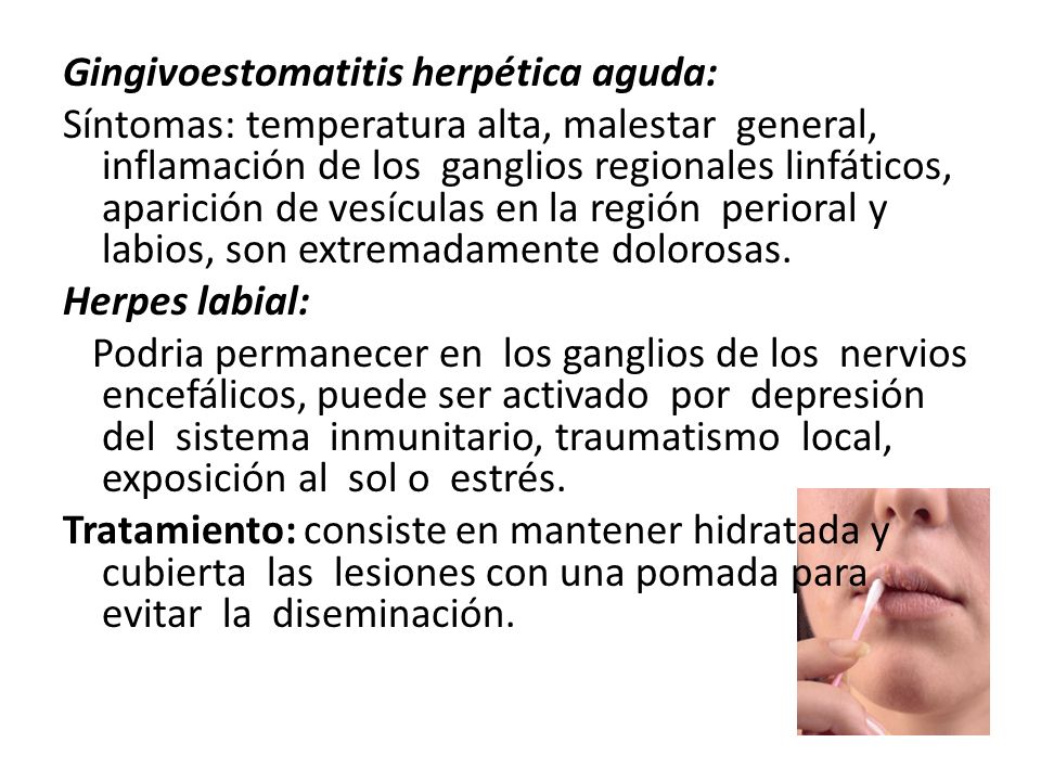 Gingivoestomatitis herpética aguda: Síntomas: temperatura alta, malestar general, inflamación de los ganglios regionales linfáticos, aparición de vesículas en la región perioral y labios, son extremadamente dolorosas.
