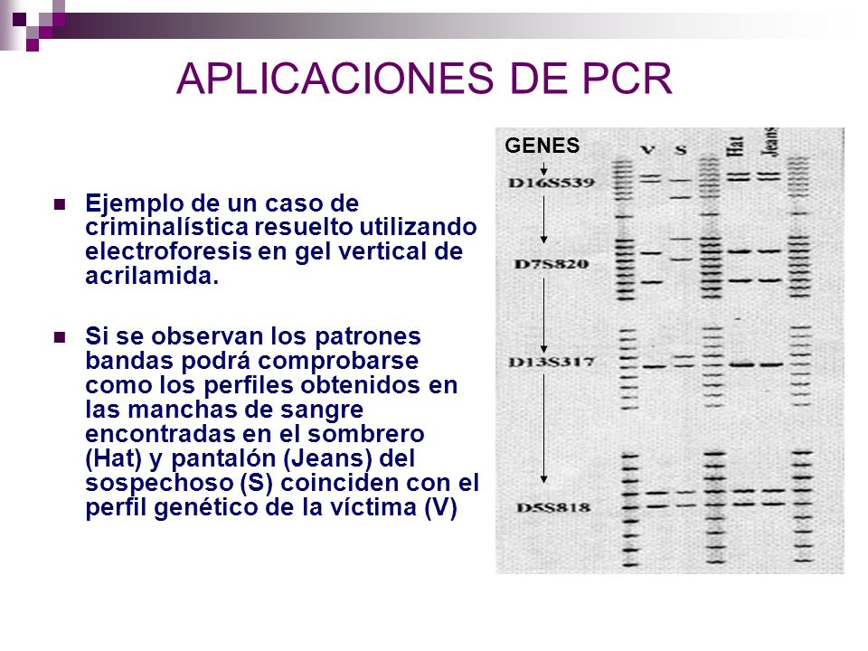 APLICACIONES DE PCR GENES. Ejemplo de un caso de criminalística resuelto utilizando electroforesis en gel vertical de acrilamida.