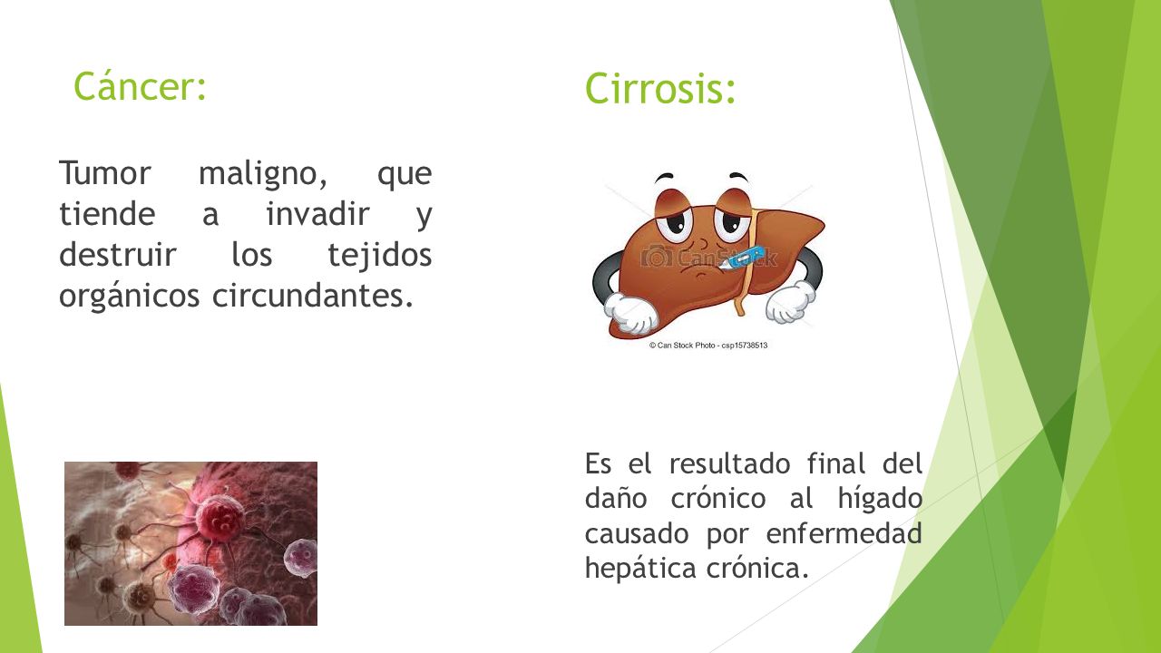 Cáncer: Cirrosis: Tumor maligno, que tiende a invadir y destruir los tejidos orgánicos circundantes.