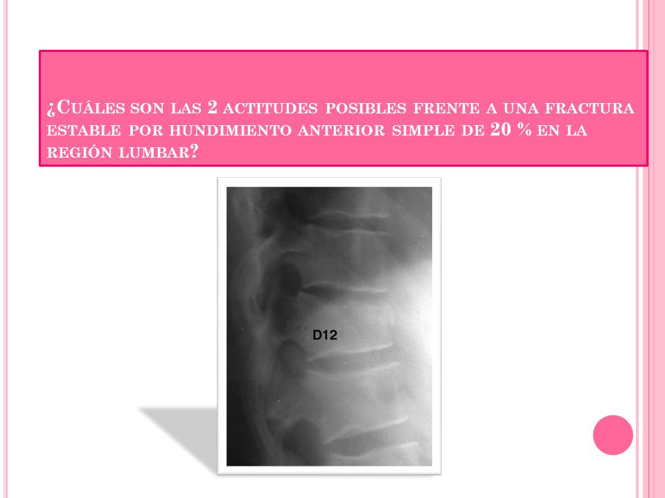 ¿Cuáles son las 2 actitudes posibles frente a una fractura estable por hundimiento anterior simple de 20 % en la región lumbar