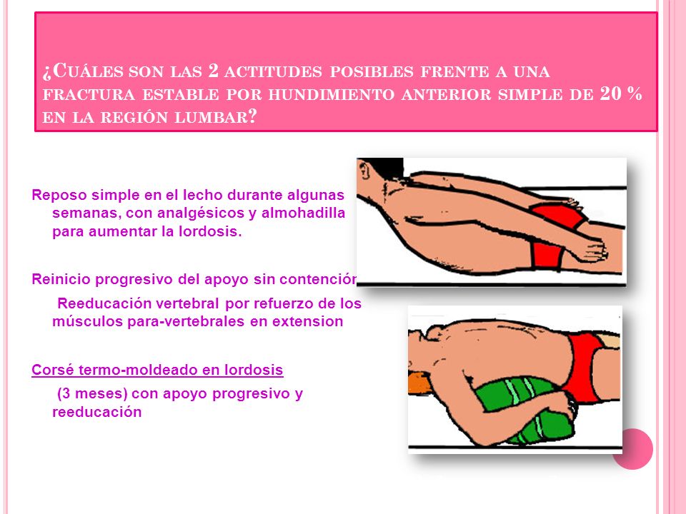 ¿Cuáles son las 2 actitudes posibles frente a una fractura estable por hundimiento anterior simple de 20 % en la región lumbar