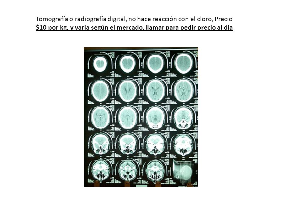 Tomografía o radiografía digital, no hace reacción con el cloro, Precio