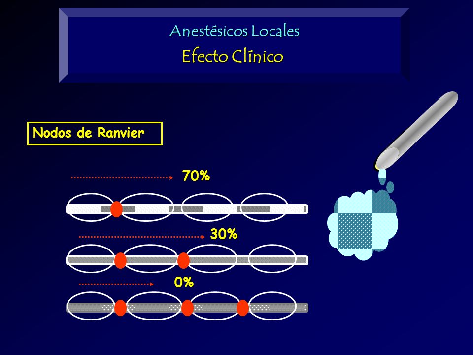 Anestésicos Locales Efecto Clínico Nodos de Ranvier 70% 30% 0%