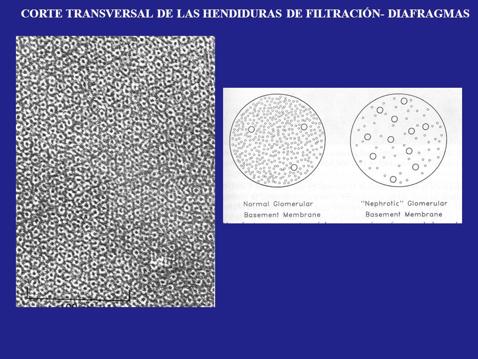 CORTE TRANSVERSAL DE LAS HENDIDURAS DE FILTRACIÓN- DIAFRAGMAS