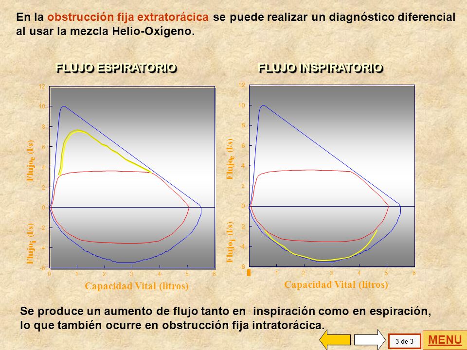 En la obstrucción fija extratorácica se puede realizar un diagnóstico diferencial al usar la mezcla Helio-Oxígeno.