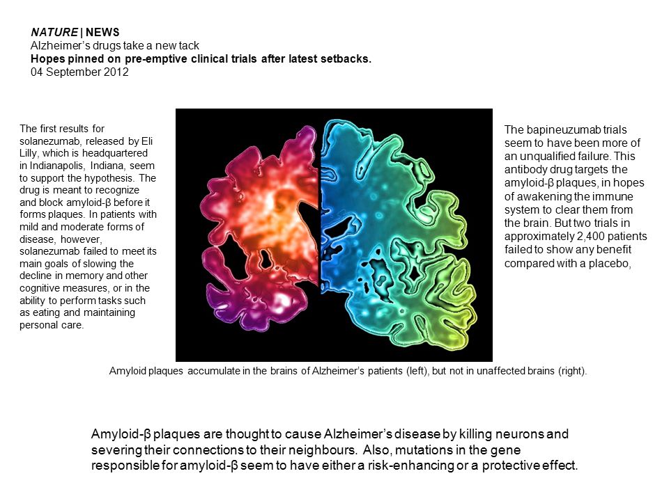NATURE | NEWS Alzheimer’s drugs take a new tack. Hopes pinned on pre-emptive clinical trials after latest setbacks.