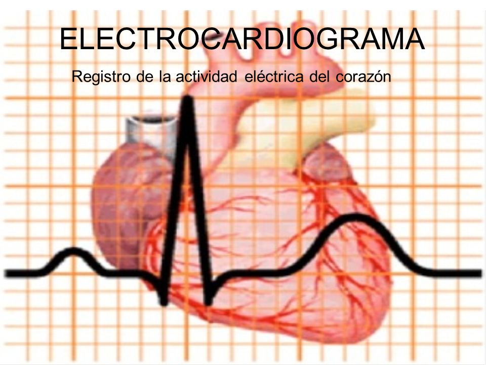 ELECTROCARDIOGRAMA Registro de la actividad eléctrica del corazón