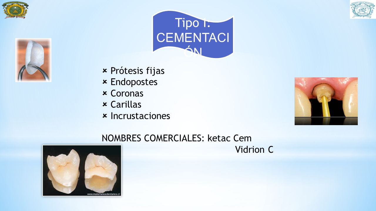 Tipo I: CEMENTACIÓN Prótesis fijas Endopostes Coronas Carillas