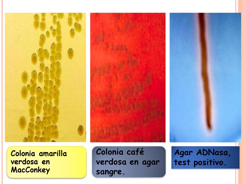 Colonia café verdosa en agar sangre. Agar ADNasa, test positivo.
