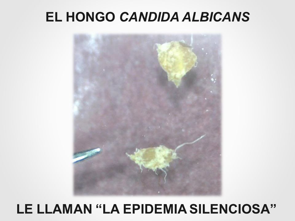EL HONGO CANDIDA ALBICANS LE LLAMAN LA EPIDEMIA SILENCIOSA