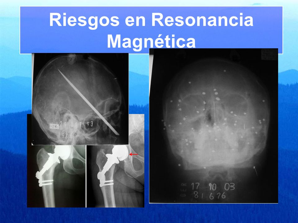 CALIDAD Y SEGURIDAD EN RADIOLOGIA RESONANCIA MAGNETICA - ppt video online  descargar