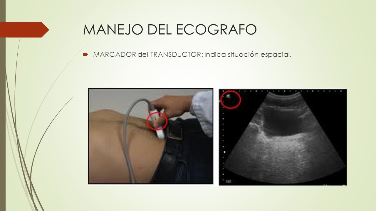MANEJO DEL ECOGRAFO MARCADOR del TRANSDUCTOR: Indica situación espacial.