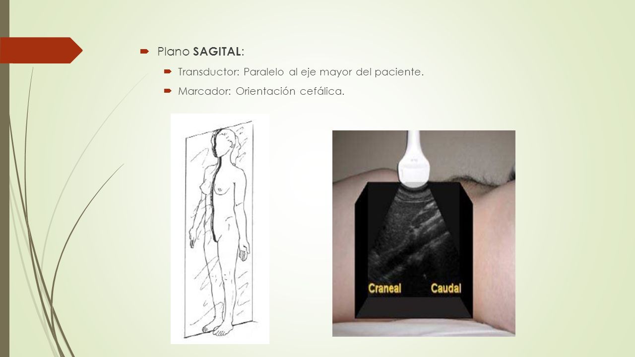 Plano SAGITAL: Transductor: Paralelo al eje mayor del paciente.