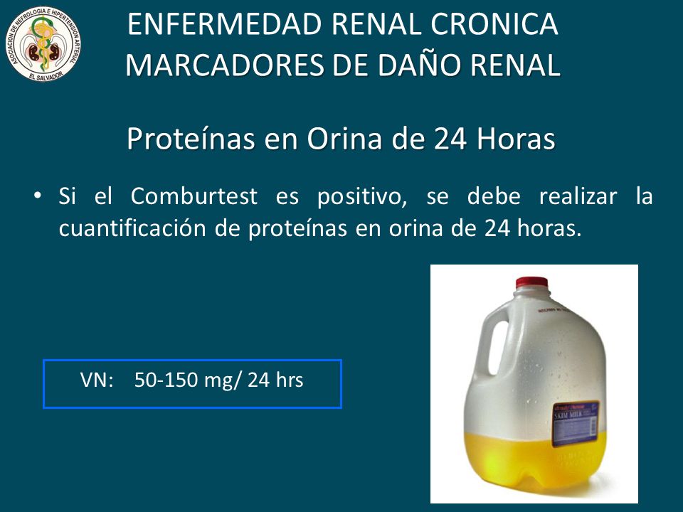 ENFERMEDAD RENAL CRONICA MARCADORES DE DAÑO RENAL