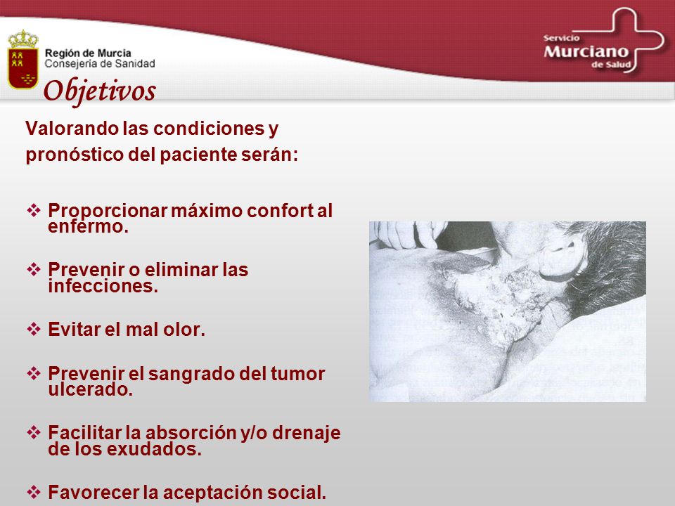 Objetivos Valorando las condiciones y. pronóstico del paciente serán: Proporcionar máximo confort al enfermo.