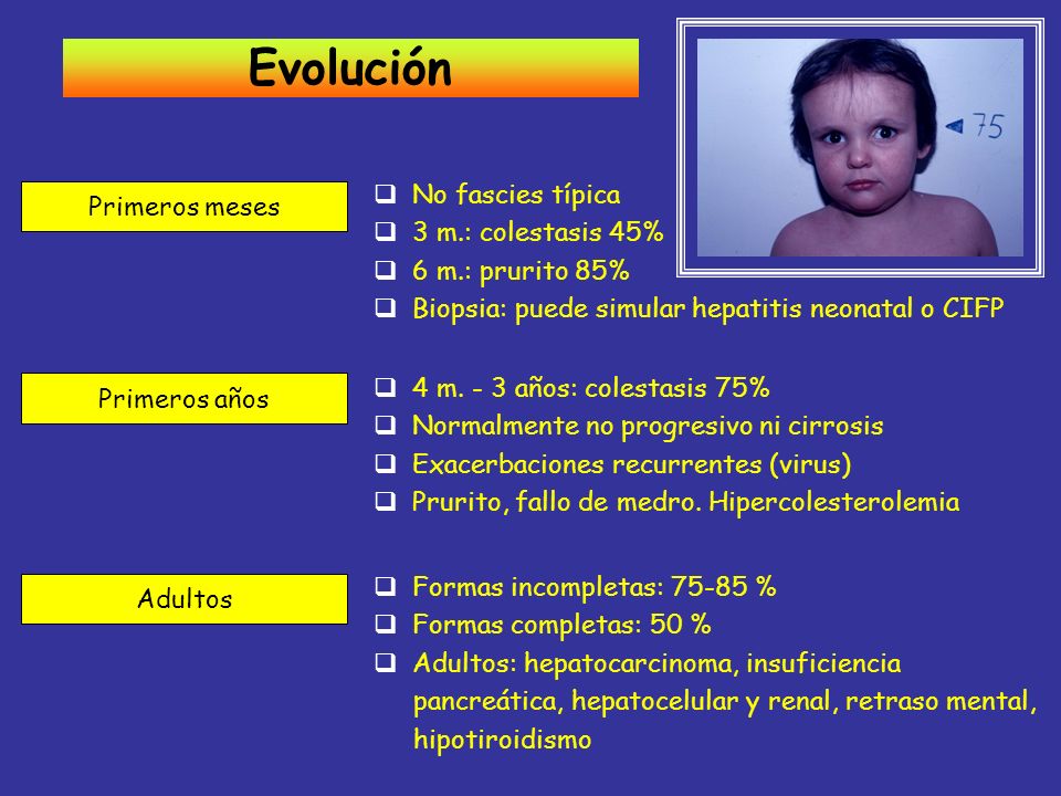 Evolución No fascies típica Primeros meses 3 m.: colestasis 45%