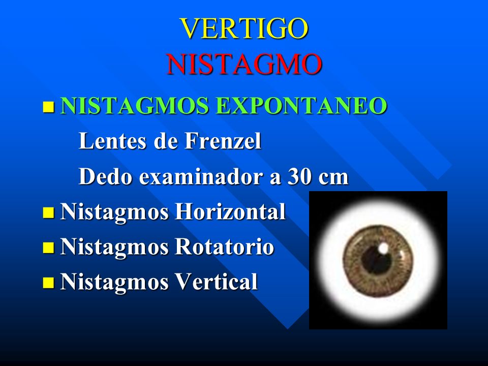 VERTIGO NISTAGMO NISTAGMOS EXPONTANEO Lentes de Frenzel