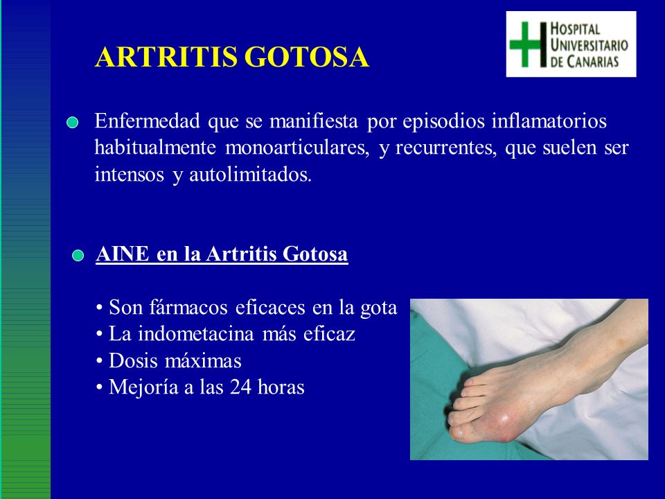 ARTRITIS GOTOSA Enfermedad que se manifiesta por episodios inflamatorios. habitualmente monoarticulares, y recurrentes, que suelen ser.