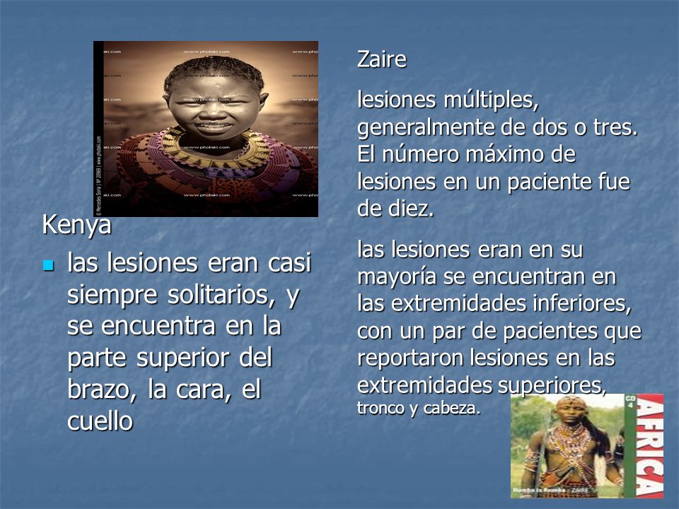 Zaire lesiones múltiples, generalmente de dos o tres. El número máximo de lesiones en un paciente fue de diez.