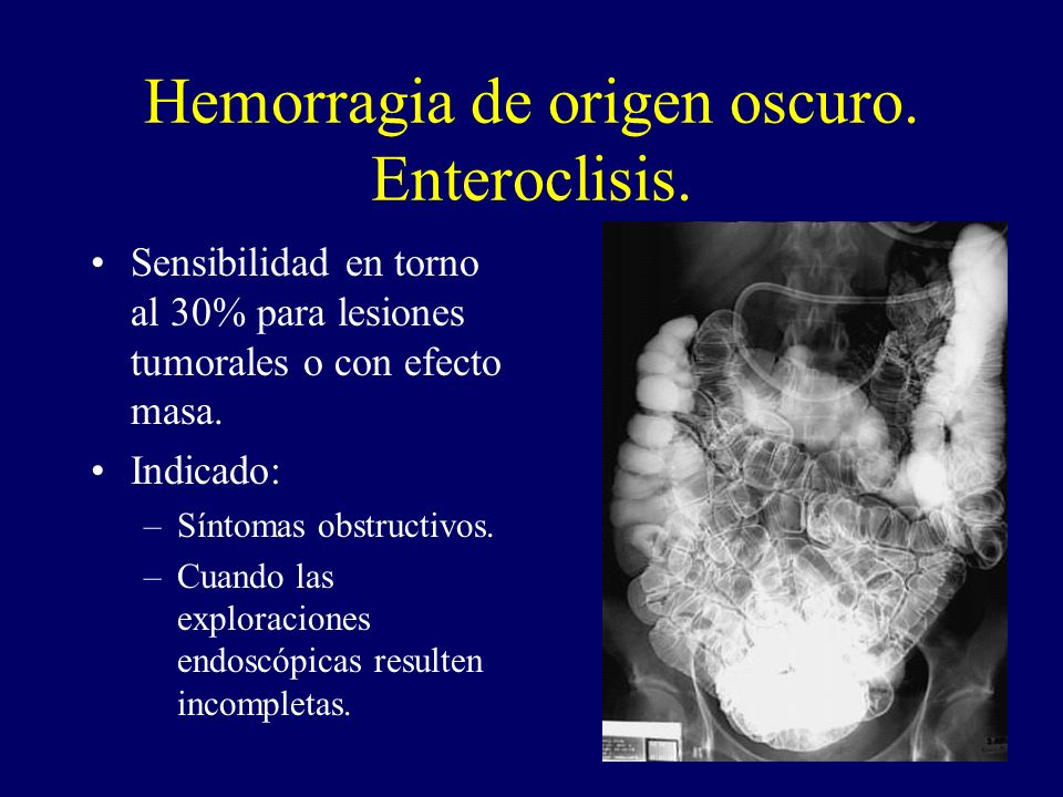 Hemorragia de origen oscuro. Enteroclisis.