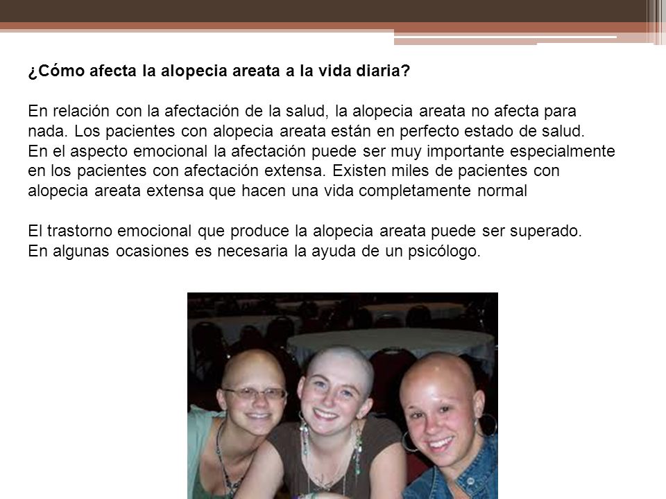 Alopecia Areata Ps Jaime E Vargas M A515TE. - ppt descargar