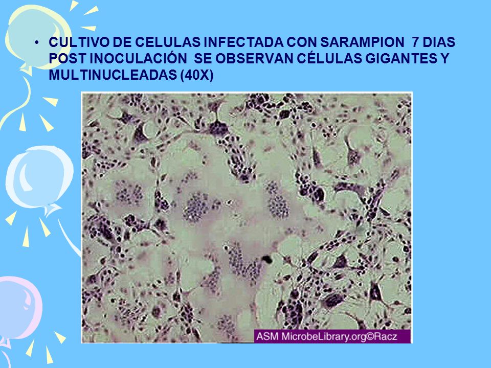 CULTIVO DE CELULAS INFECTADA CON SARAMPION 7 DIAS POST INOCULACIÓN SE OBSERVAN CÉLULAS GIGANTES Y MULTINUCLEADAS (40X)