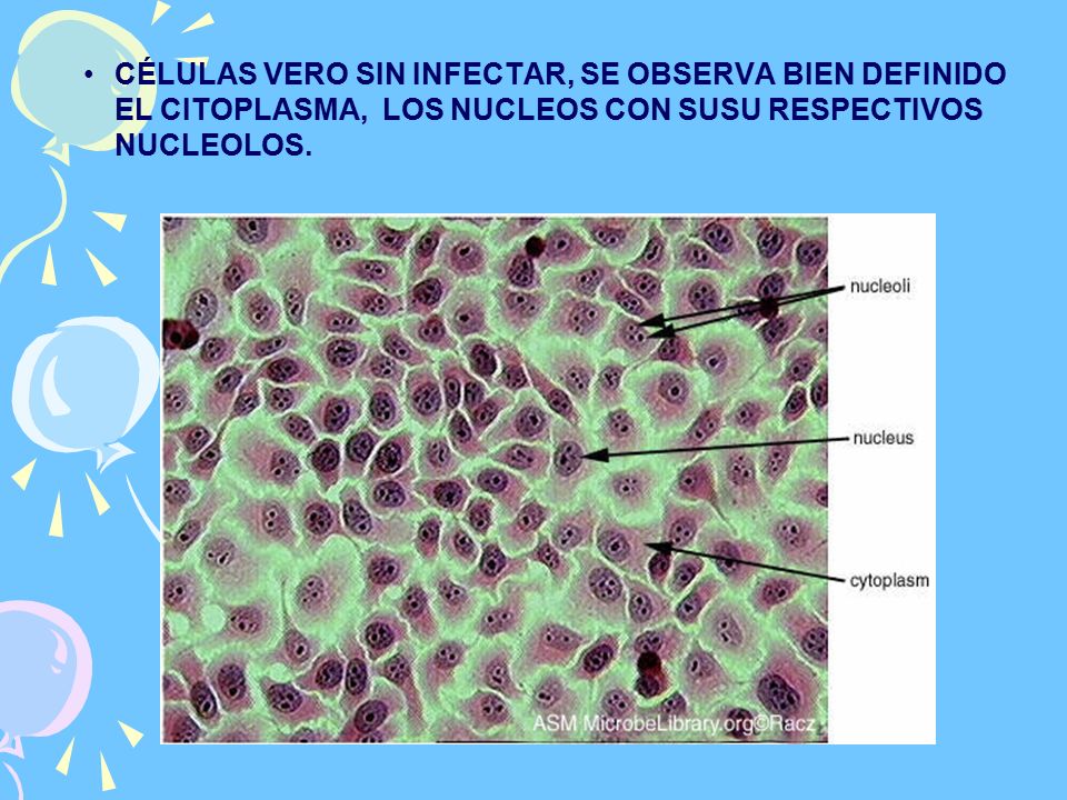 CÉLULAS VERO SIN INFECTAR, SE OBSERVA BIEN DEFINIDO EL CITOPLASMA, LOS NUCLEOS CON SUSU RESPECTIVOS NUCLEOLOS.