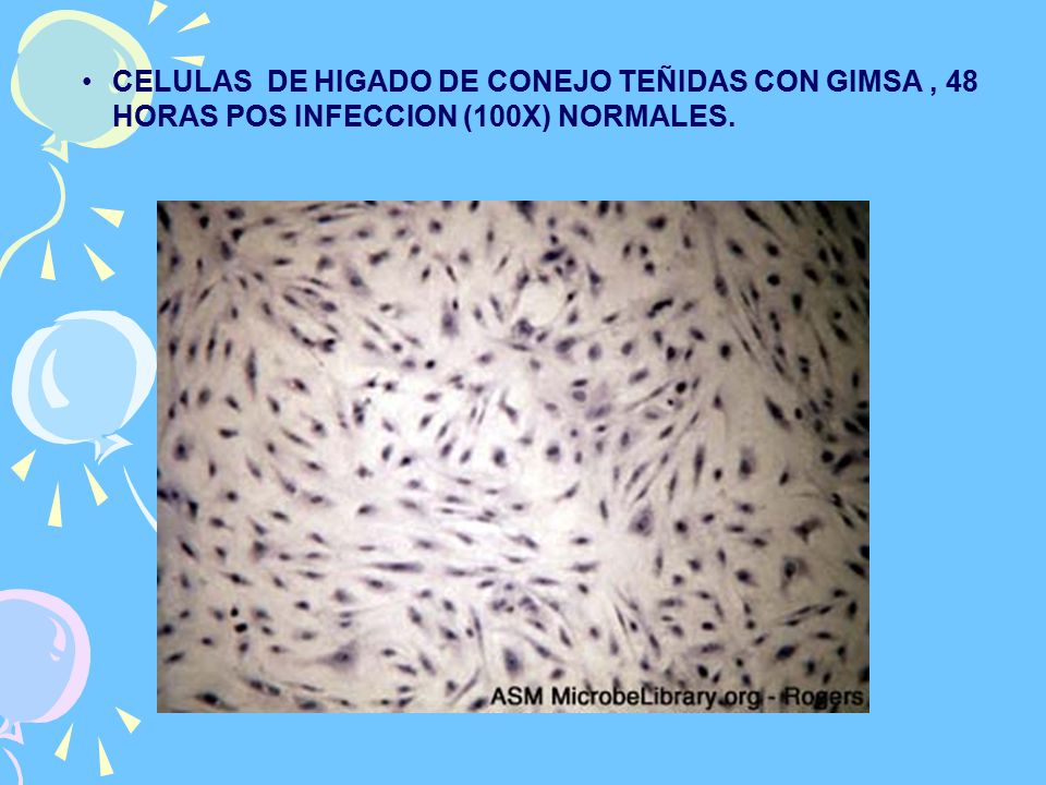 CELULAS DE HIGADO DE CONEJO TEÑIDAS CON GIMSA , 48 HORAS POS INFECCION (100X) NORMALES.