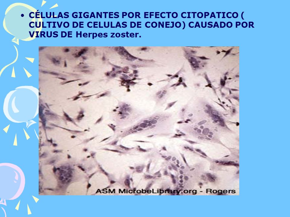 CÉLULAS GIGANTES POR EFECTO CITOPATICO ( CULTIVO DE CELULAS DE CONEJO) CAUSADO POR VIRUS DE Herpes zoster.