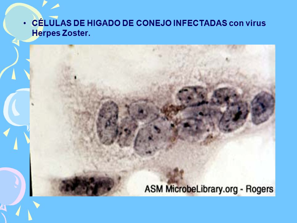 CÉLULAS DE HIGADO DE CONEJO INFECTADAS con virus Herpes Zoster.