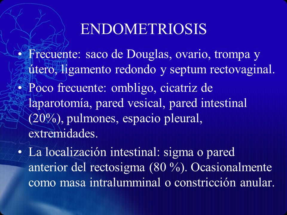 ENDOMETRIOSIS Frecuente: saco de Douglas, ovario, trompa y útero, ligamento redondo y septum rectovaginal.