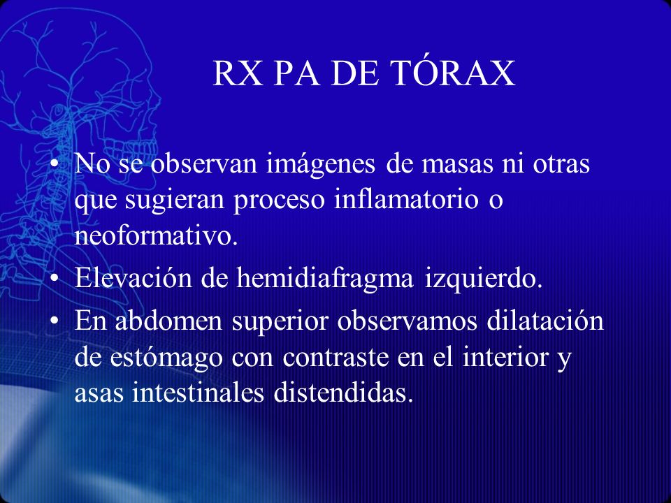 RX PA DE TÓRAX No se observan imágenes de masas ni otras que sugieran proceso inflamatorio o neoformativo.