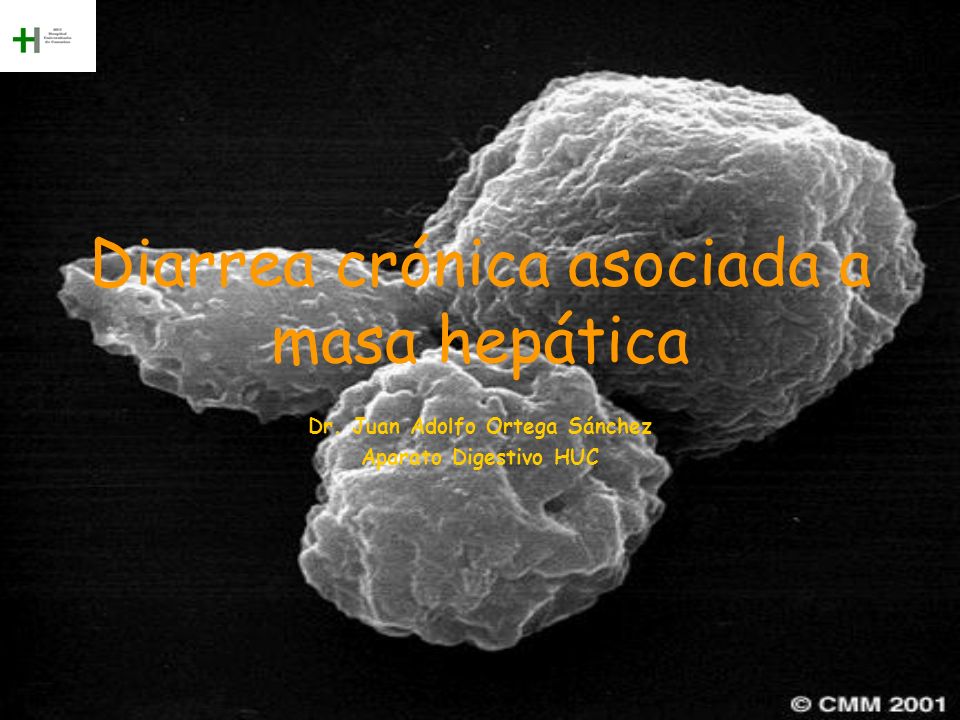 Diarrea crónica asociada a masa hepática