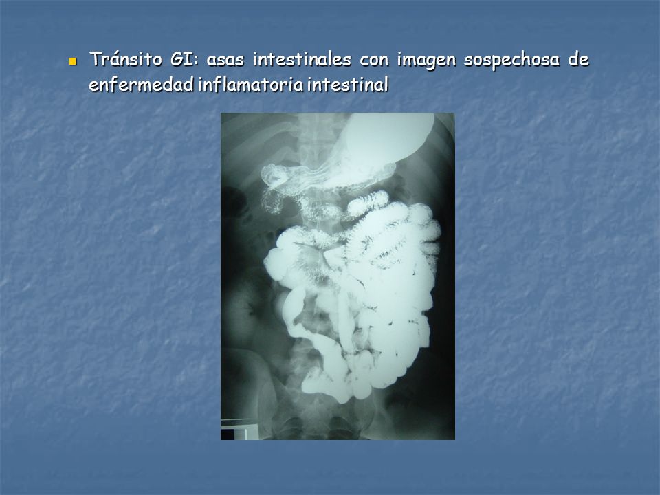 Tránsito GI: asas intestinales con imagen sospechosa de enfermedad inflamatoria intestinal