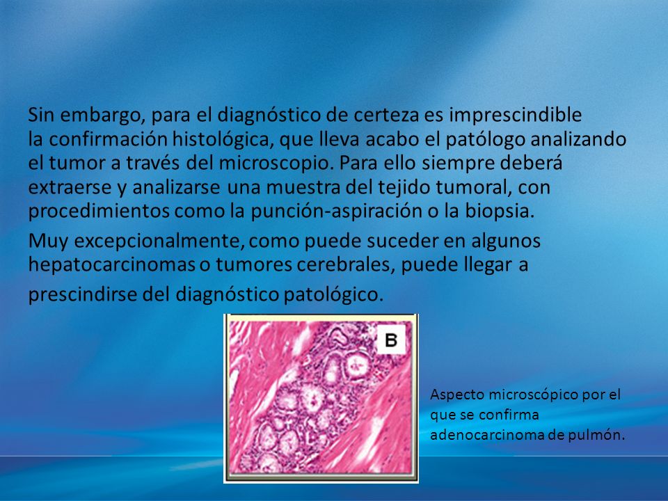 Sin embargo, para el diagnóstico de certeza es imprescindible la confirmación histológica, que lleva acabo el patólogo analizando el tumor a través del microscopio. Para ello siempre deberá extraerse y analizarse una muestra del tejido tumoral, con procedimientos como la punción-aspiración o la biopsia. Muy excepcionalmente, como puede suceder en algunos hepatocarcinomas o tumores cerebrales, puede llegar a prescindirse del diagnóstico patológico.