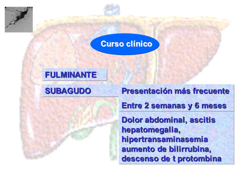 Curso clínico FULMINANTE. SUBAGUDO. Dolor abdominal, ascitis hepatomegalia, hipertransaminasemia aumento de bilirrubina, descenso de t protombina.