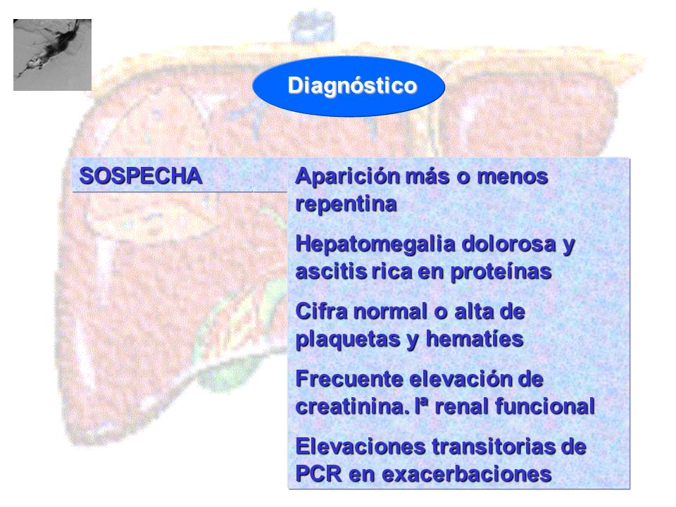 Diagnóstico SOSPECHA. Aparición más o menos repentina. Hepatomegalia dolorosa y ascitis rica en proteínas.
