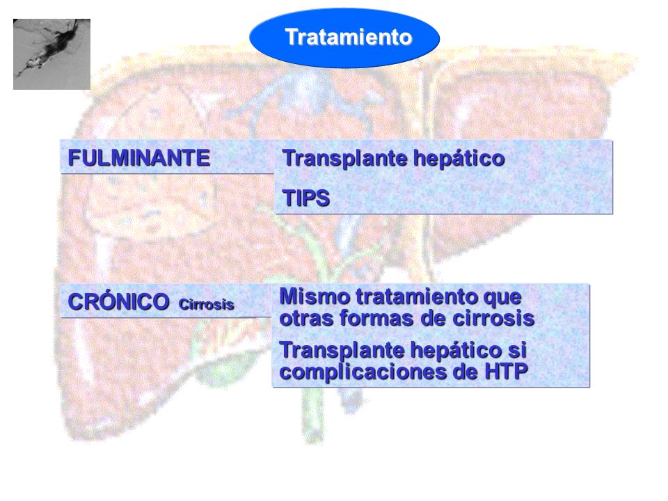 Tratamiento FULMINANTE. Transplante hepático. TIPS. CRÓNICO Cirrosis. Mismo tratamiento que otras formas de cirrosis.