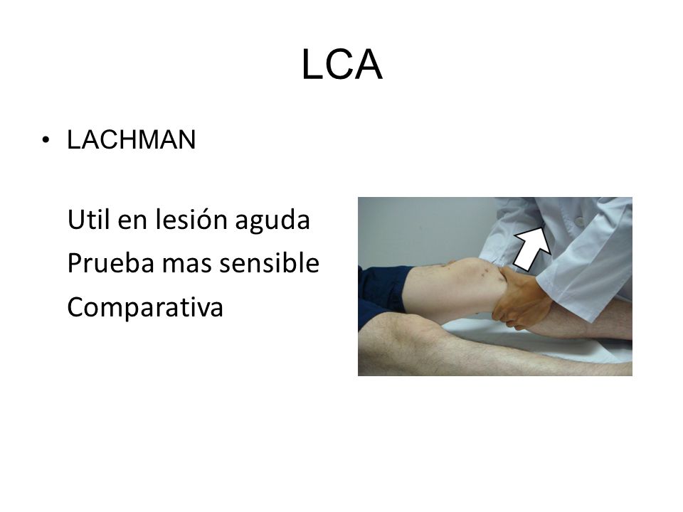 LCA Util en lesión aguda Prueba mas sensible Comparativa LACHMAN