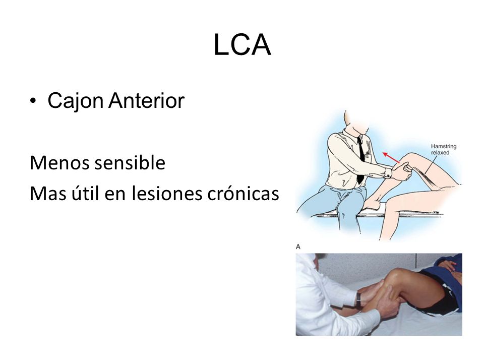 LCA Cajon Anterior Menos sensible Mas útil en lesiones crónicas