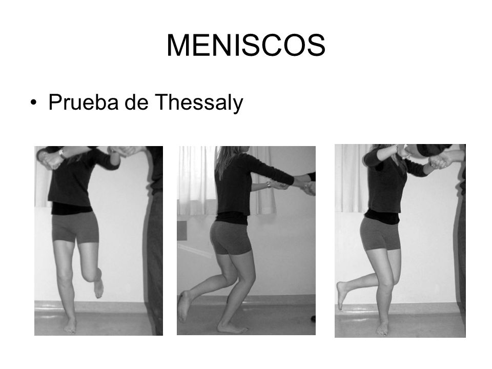 MENISCOS Prueba de Thessaly